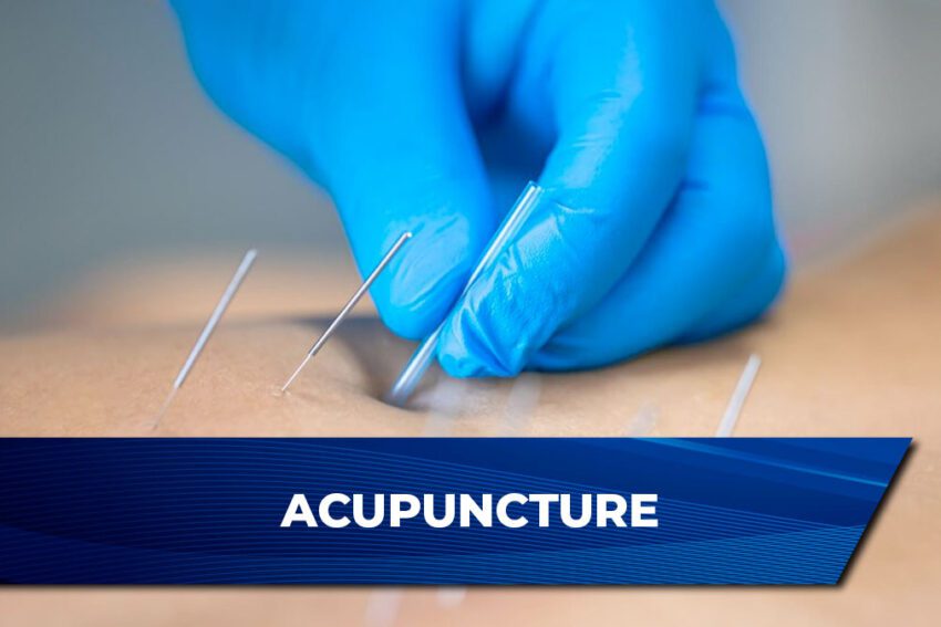 Acupuncture El Paso TX